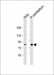 PCCA Antibody (Center)